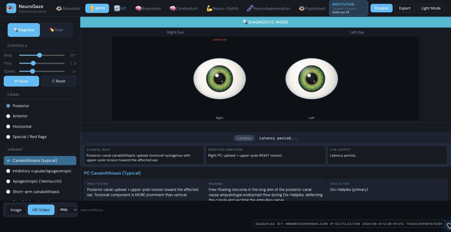 BPPV module screenshot