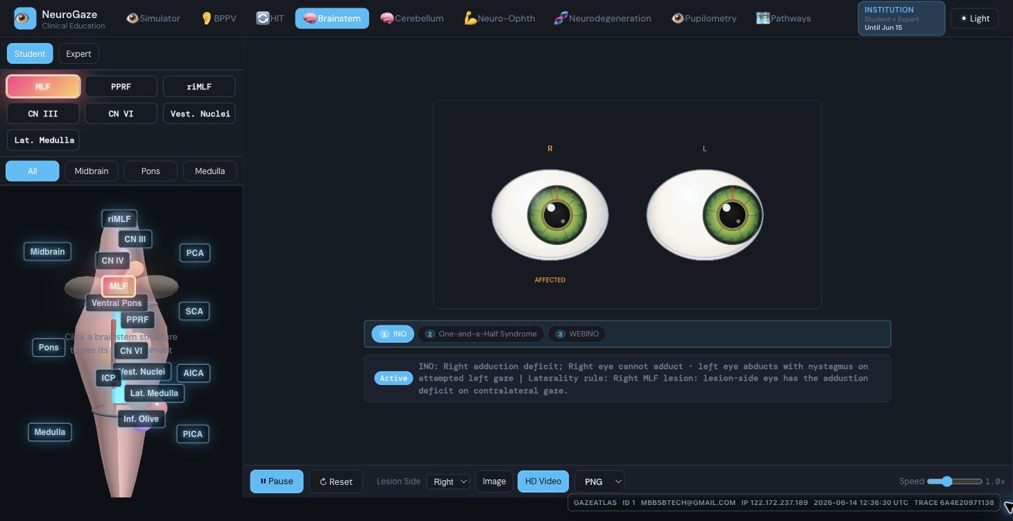 Brainstem module screenshot