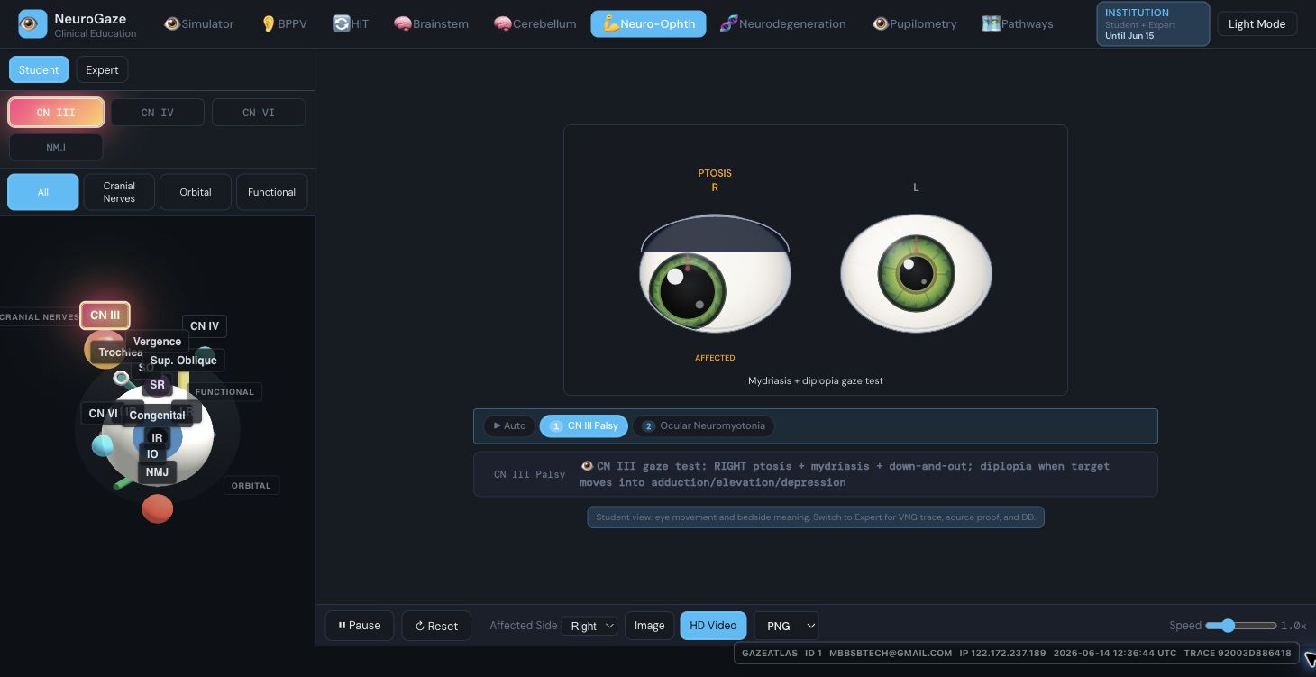 Neuro-Ophth module screenshot