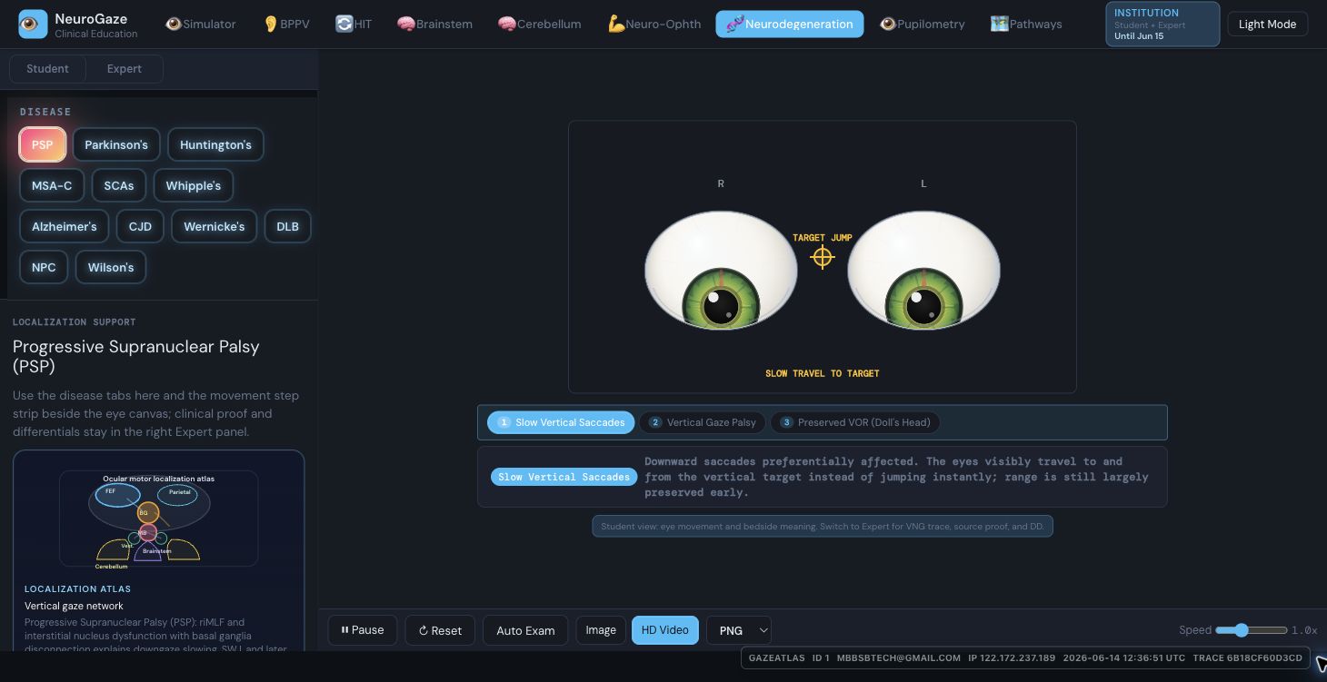 Neurodegeneration module screenshot