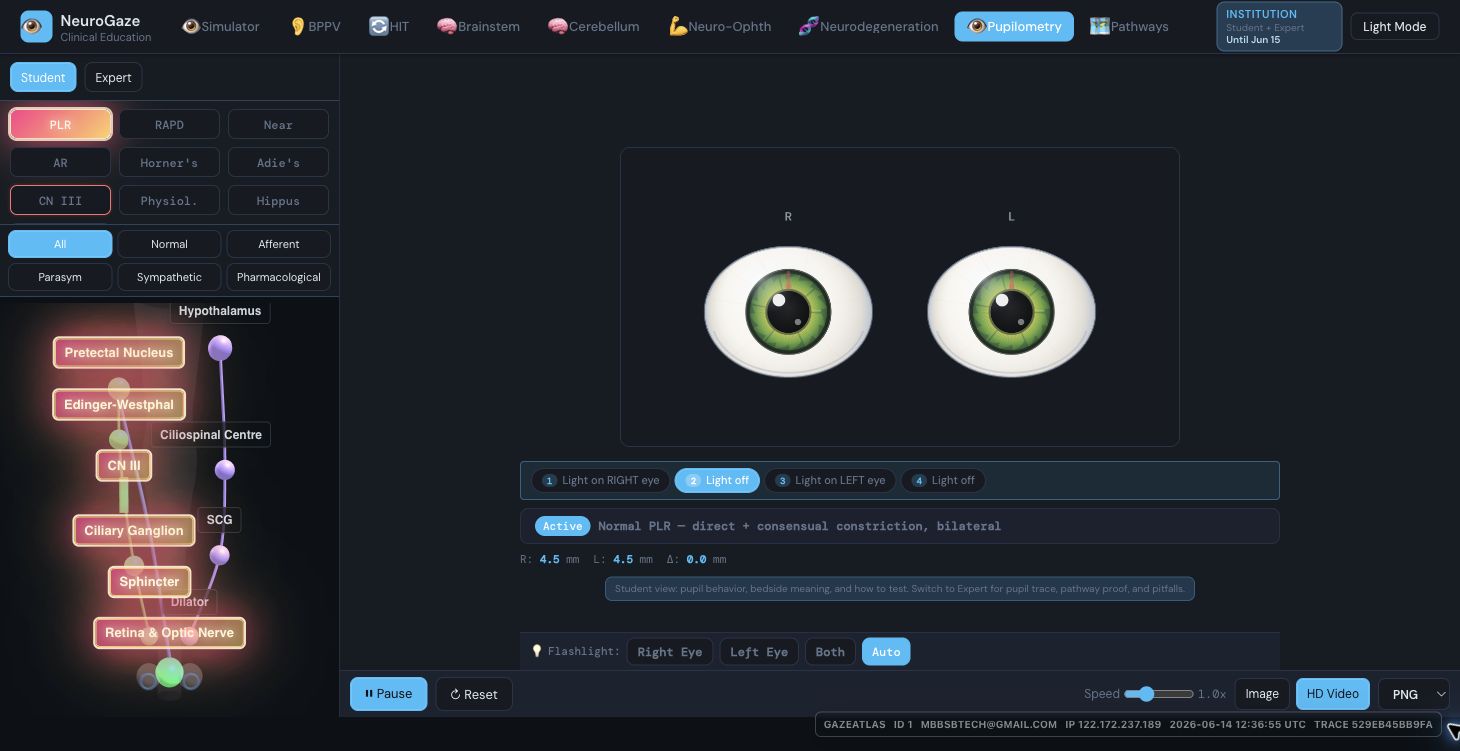 Pupilometry module screenshot